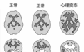 为什么我没有成为杀人犯？​|一个心理变态者的自白