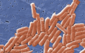 美国沙门氏菌疫情已致43州640人感染 来源或为洋葱