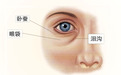 刘风卓科普| 眼袋怎么消除好方法