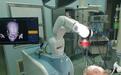 上海专家成功使用3D结构光手术机器人治疗脑出血