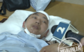 事发南昌！10米电线杆突然倒下砸到男子头 多部门表示电线杆不是自己的