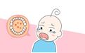 疱疹性咽峡炎——疾病预防开学第一课