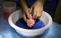 史上首次！美国成功将猪肾植入人体 中国器官移植专家怎么看？