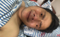 因百万年薪被骗到缅甸 小伙逃跑时遭殴打至手腿粉碎性骨折