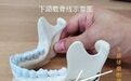 下颌角长曲线和超长曲线和下巴环切的区别|籍建华下颌角
