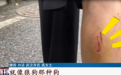 女子遛狗被另一条狗咬伤 双方各执一词 警方介入！