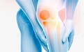 氨糖真的对膝关节有治疗作用吗？维固力抵抗骨关节炎，缓解疼痛更给力