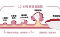 潍坊市人民医院|酒肉穿肠过 肠镜你得做