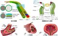 哈工大团队研发毫米级连续体机器人助力腔内介入手术精准安全