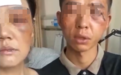 网传夫妻二人被农行员工殴打至昏迷，银行回应