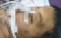 安徽籍一男童疑遭“后妈”虐待进ICU 多家媒体报道男童已离世