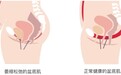 Gynable洁妮贝盆底宝：革新女性盆底修复，重塑健康未来