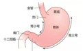 81岁老人胃总反酸查出胃癌 医生用“天花板级”术式再造贲门 实现新突破！