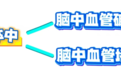 如何识别？健康路上的“突袭者”——脑卒中！