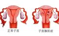 月经淋漓不尽且肚大如孕 海口一女子被病痛折磨陷焦虑 专家贾利平巧手为其除病痛