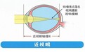 爱尔英智唐琰提醒家长朋友：这个暑假，别让甜品“偷走”孩子的视力！