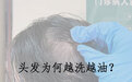 洗发水哪个牌子好控油蓬松？医生推荐这款控油洗发水发根持久蓬松