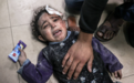 联合国：至少2.1万名加沙儿童因战争致残