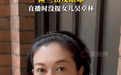 53岁吴绮莉直播回应受伤：眼睛被树枝划伤险伤眼球