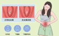 这个门诊只有女医生坐诊！14岁以下女孩出现这些问题请进