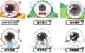 佳木斯首台｜佳木斯爱尔眼科引入热脉动睑板腺治疗仪，解锁干眼治疗“黑科技”