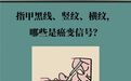 指甲黑线竖纹横纹　哪些是癌变信号