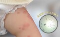 哪款除螨喷雾效果好？是不是用完就见效？仙贝宁即时消杀 + 长效防护双重保障