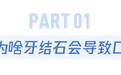 洗牙会伤害牙齿和牙周组织吗