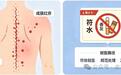 胸背长蛇缠腰？千万别涂符水
