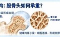 【南京股骨髋医院|保髋新知】股骨头修复，就像修一栋危房：先保框架，再搞装修！