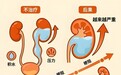 双肾遭遇结石梗阻！南昌康德医院微创一次性处理双侧结石，守护肾功能