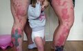 英国：小女孩身上现大片胎记 父母纹同款纹身(图)