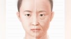 <em>Great</em> Anatomy减少手术副作用 使K-beauty更上一层楼