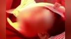 阜阳一学生眼睑被老师打出<em>3cm</em>裂伤！当地教育局回应