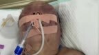 43岁女子被前夫殴打生命垂危在<em>ICU</em>抢救，家属称她屡遭家暴离婚证照片脸部肿胀变形，嫌疑人已被刑拘