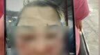 被前夫打进<em>ICU</em>的女子不幸身亡，大女儿称正送母亲去殡仪馆，今后安排暂未考虑，希望严惩凶手