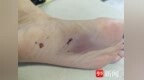 常州“00后”辅警10米高桥跳下河救人，赤裸上身光脚一瘸一拐走回派出所让人心疼