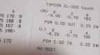 分享日记：青岛<em>icl</em>晶体植入术3个月