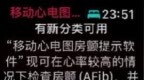 国行Apple Watch获推心电图2.0算法，需更新至10.2 <em>DB2</em>
