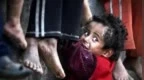 世卫组织：官方记录显示10名加沙地带儿童在医院被登记为“饿死”