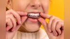 并非所有儿童都需要早期矫治，走出儿童牙齿矫正误区