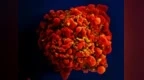 重磅！全球第7例HIV治愈者详情公布，为什么说这次特殊