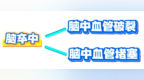 如何识别？健康路上的“突袭者”——脑卒中！