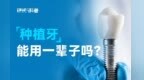 硬核科普：种植牙能用一辈子吗？