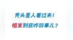 “秃头星人”看过来，植发到底咋回事儿！
