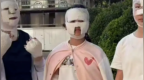 野外烧烤遇卡式炉爆炸！7人被炸伤，包成“木乃伊”，当事人发声
