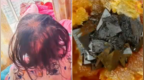 3岁女童大把脱发查出急性铊中毒，这么危险的铊到底哪儿来的？