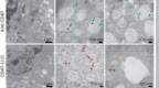 ATC：一种抗体毒素偶联物癌症免疫治疗
