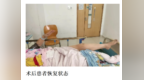 争分夺秒！城阳人民医院机械取栓术为76岁脑梗患者重启“生命通道”