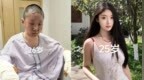 27岁美妆博主烧伤毁容：与自己和解，打算重新做美妆账号